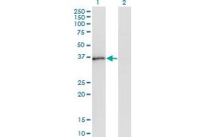 Western Blot analysis of PQBP1 expression in transfected 293T cell line by PQBP1 monoclonal antibody (M01), clone 1A11. (PQBP1 antibody  (AA 184-265))