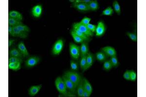Immunofluorescence staining of HepG2 cells with ABIN7165566 at 1:133, counter-stained with DAPI. (FAM83D antibody  (AA 339-470))