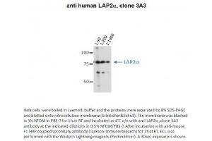 Image no. 1 for anti-Thymopoietin (TMPO) (AA 650-750) antibody (ABIN1042619) (Thymopoietin antibody  (AA 650-750))