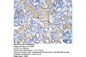 Rabbit Anti-EIF3S4 Antibody  Paraffin Embedded Tissue: Human Kidney Cellular Data: Epithelial cells of renal tubule Antibody Concentration: 4. (EIF3G antibody  (N-Term))