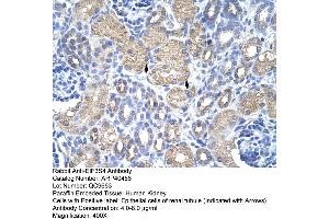 Rabbit Anti-EIF3S4 Antibody  Paraffin Embedded Tissue: Human Kidney Cellular Data: Epithelial cells of renal tubule Antibody Concentration: 4.