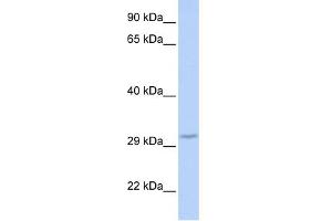 WB Suggested Anti-FBXO27 Antibody Titration: 0. (FBXO27 antibody  (Middle Region))
