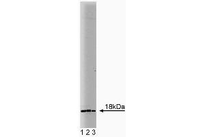 Western blot analysis of Ubc9 on human endothelial lysate. (UBE2I antibody  (AA 26-156))