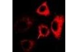 Immunofluorescent analysis of RPL13 staining in MCF7 cells. (RPL13 antibody)