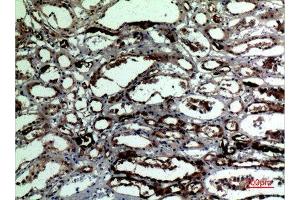 Immunohistochemistry (IHC) analysis of paraffin-embedded Human Kidney, antibody was diluted at 1:100. (Catalase antibody  (C-Term))