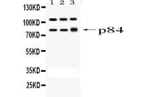 Western blot analysis of STAT1 using anti-STAT1 antibody . (STAT1 antibody  (AA 2-230))