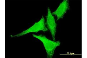 Immunofluorescence of monoclonal antibody to HSF2 on HeLa cell. (HSF2 antibody  (AA 1-230))