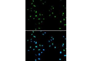 Immunofluorescence analysis of A549 cells using HDAC4 antibody. (HDAC4 antibody  (AA 530-630))