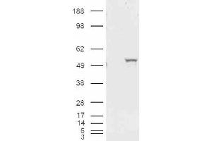 HEK293 overexpressing ALDH1A1 and probed with ABIN185587 (mock transfection in first lane).