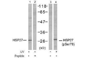 Image no. 1 for anti-Heat Shock 27kDa Protein 1 (HSPB1) (pSer78) antibody (ABIN197002)