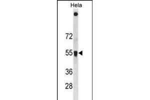 SQSTM1 Antibody (C-term ) (ABIN1881829 and ABIN2838612) western blot analysis in Hela cell line lysates (35 μg/lane). (SQSTM1 antibody  (C-Term))