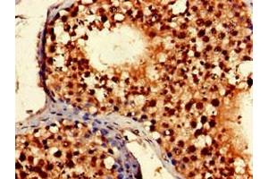 Immunohistochemistry of paraffin-embedded human testis tissue using ABIN7169201 at dilution of 1:100 (TLK2 antibody  (AA 23-234))