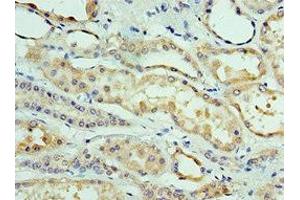 Immunohistochemistry of paraffin-embedded human kidney tissue using ABIN7147915 at dilution of 1:100 (CLDN8 antibody  (AA 141-225))
