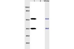 Lane 1: rat brain lysates Lane 2: rat heart lysates probed with Anti phospho-CHEK1(Ser317) Polyclonal Antibody, Unconjugated (ABIN757072) at 1:200 in 4 °C. (CHEK1 antibody  (pSer317))