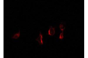 ABIN6267278 staining 293 by IF/ICC. (Estrogen Receptor alpha antibody  (pSer118))