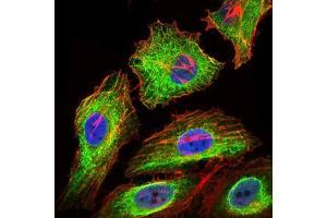 Immunofluorescence analysis of HeLa cells using GPC3 mouse mAb (green). (Glypican 3 antibody)
