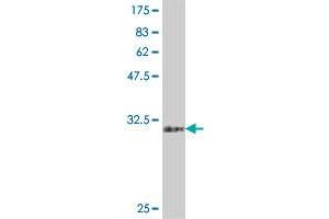 Western Blot detection against Immunogen (33. (Homeobox C5 antibody  (AA 1-68))