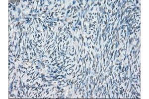 Image no. 11 for anti-P450 (Cytochrome) Oxidoreductase (POR) antibody (ABIN1497743) (POR antibody)