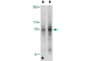 Western blot analysis of FNIP2 in mouse skeletal muscle tissue lysate with FNIP2 polyclonal antibody  at (A) 1 and (B) 2 ug/mL .