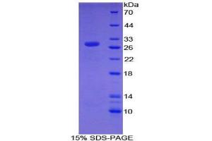 SDS-PAGE analysis of Mouse CHD3 Protein. (CHD3 Protein)