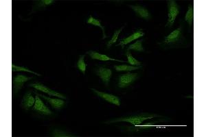 Immunofluorescence of purified MaxPab antibody to TXNDC9 on HeLa cell. (TXNDC9 antibody  (AA 1-188))
