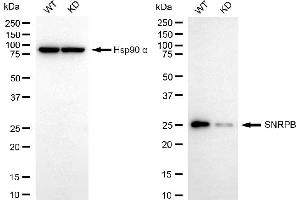 Western blotting analysis using SNRPB antibody (ABIN7800381). (SNRPB antibody)