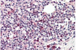 Human Spleen (formalin-fixed, paraffin-embedded) stained with TFEC antibody ABIN337184 at 5 ug/ml followed by biotinylated anti-goat IgG secondary antibody ABIN481715, alkaline phosphatase-streptavidin and chromogen. (TFEC antibody  (AA 217-228))