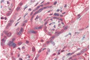 Human Placenta (formalin-fixed, paraffin-embedded) stained with FAIM antibody ABIN337178 at 2. (FAIM antibody  (AA 121-132))