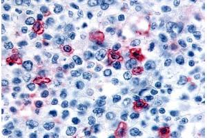 Anti-HRH4 / Histamine H4 Receptor antibody  ABIN1048964 IHC staining of human lymph node. (HRH4 antibody  (Cytoplasmic Domain))