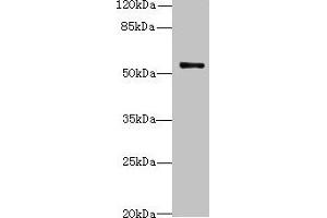 Western blot All lanes: TRIM38 antibody at 4 μg/mL + Jurkat whole cell lysate Secondary Goat polyclonal to rabbit IgG at 1/10000 dilution Predicted band size: 54 kDa Observed band size: 54 kDa (TRIM38 antibody  (AA 45-259))