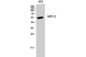 Western Blotting (WB) image for anti-Myelin Expression Factor 2 (MYEF2) (Ser89) antibody (ABIN3185509) (MYEF2 antibody  (Ser89))
