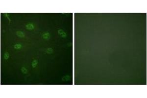 Immunofluorescence (IF) image for anti-GATA Binding Protein 4 (GATA4) (AA 71-120) antibody (ABIN2888840) (GATA4 antibody  (AA 71-120))