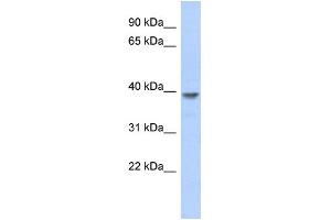 WB Suggested Anti-MED8 Antibody Titration: 0. (MED8 antibody  (N-Term))
