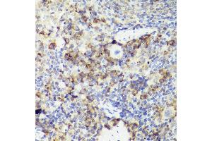 Immunohistochemistry of paraffin-embedded mouse spleen using IL18 antibody (ABIN7267992) at dilution of 1:50 (40x lens). (IL-18 antibody)
