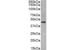 Western Blot using anti-CCR5 (phosphoserine 349) antibody E11/19. (Recombinant CCR5 antibody  (pSer349))