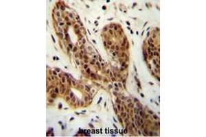 CI150 Antibody (N-term) immunohistochemistry analysis in formalin fixed and paraffin embedded human breast tissue followed by peroxidase conjugation of the secondary antibody and DAB staining.