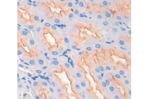 Figure. (RALBP1 antibody  (AA 527-626))
