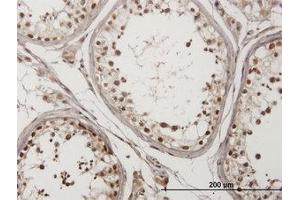 Image no. 1 for anti-Checkpoint Kinase 2 (CHEK2) (AA 1-544) antibody (ABIN599174) (CHEK2 antibody  (AA 1-544))