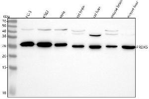 Western blot analysis of PRDX6 using anti-PRDX6 antibody (ABIN7606033).