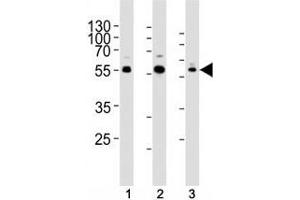 Western blot analysis of lysate from human (1) Jurkat, (2) PC3, and rat (3) C6 cells using AKT1/2/3 antibody at 1:1000.