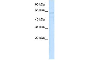 WB Suggested Anti-ZNF426 Antibody   Titration: 2.