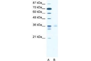 WB Suggested Anti-LHX3 Antibody   Titration: 2. (LHX3 antibody  (Middle Region))