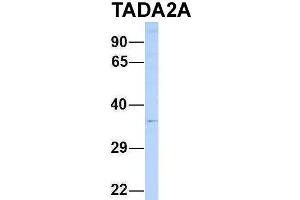 Host:  Rabbit  Target Name:  TADA2A  Sample Type:  721_B  Antibody Dilution:  1. (TADA2L antibody  (N-Term))