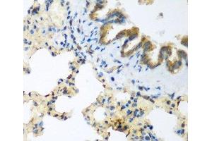 Immunohistochemistry of paraffin-embedded Rat lung using LLGL2 Polyclonal Antibody at dilution of 1:200 (40x lens). (LLGL2 antibody)