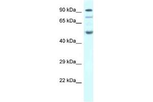 Western Blot showing SESN2 antibody used at a concentration of 1 ug/ml against Fetal Heart Lysate (Sestrin 2 antibody  (C-Term))