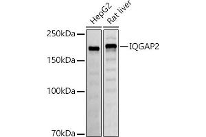 Western blot analysis of extracts of various cell lines, using IQG antibody (ABIN7268021) at 1:500 dilution. (IQGAP2 antibody)