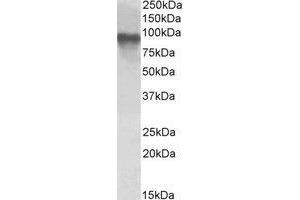 AP23665PU-N TORC2 antibody staining of Jurkat lysate at 1 µg/ml (35 µg protein in RIPA buffer). (CRTC2 antibody  (C-Term))
