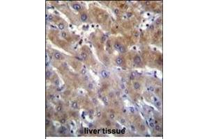 ANKRD18B Antibody (N-term) (ABIN655769 and ABIN2845209) immunohistochemistry analysis in formalin fixed and paraffin embedded human liver tissue followed by peroxidase conjugation of the secondary antibody and DAB staining.
