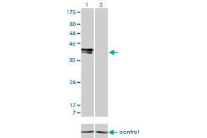 Western blot analysis of ISL1 over-expressed 293 cell line, cotransfected with ISL1 Validated Chimera RNAi (Lane 2) or non-transfected control (Lane 1). (ISL1 antibody  (AA 63-159))