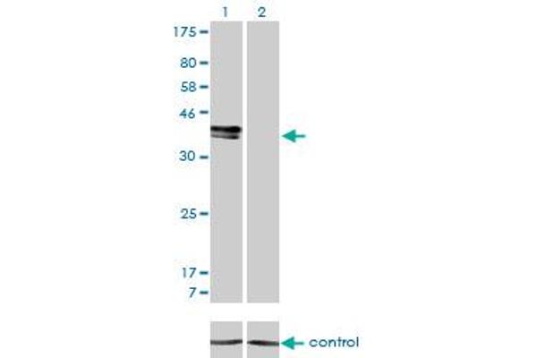 ISL1 anticorps  (AA 63-159)